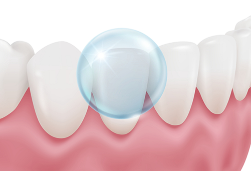 Illustration of fluoride being applied to teeth