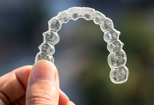 Close up of SureSmile clear aligner held between finger and thumb