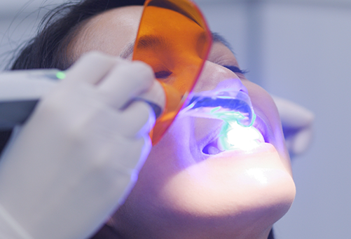 Female patient having teeth whitening performed