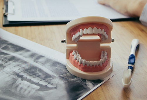 Model of teeth on top of dental X-ray on desk