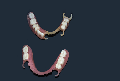 Two partial dentures on a black background
