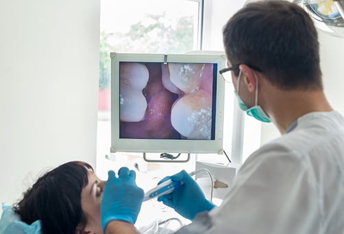 Checking patient's teeth with an intraoral camera