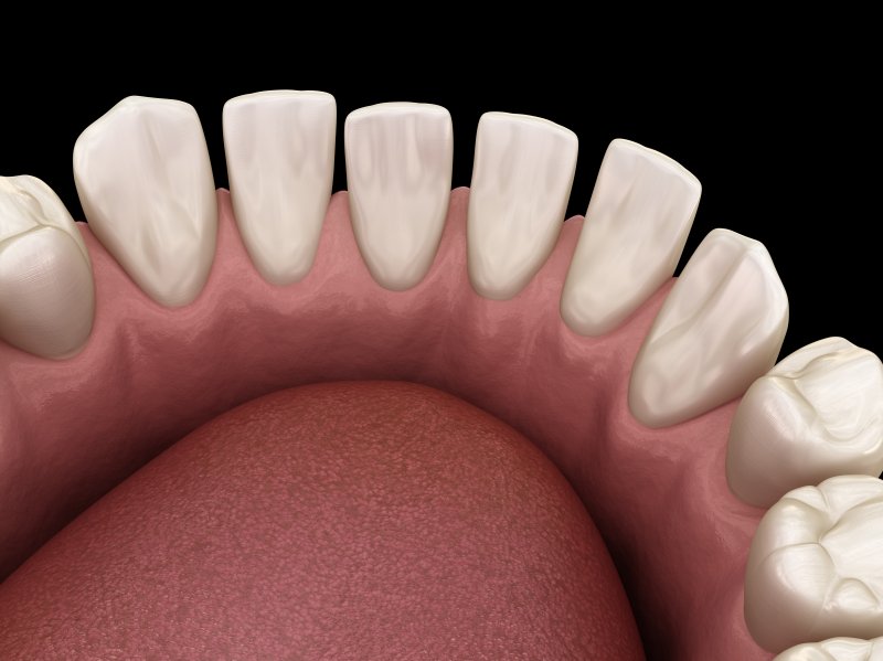 Illustration of spaced-out teeth